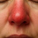 The Hidden Power of Green Pine Cones – Nature’s Overlooked Miracle