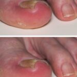 You are doing it all wrong. Here’s the right way to use honey for healing