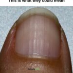 You are doing it all wrong. Here’s the right way to drink pickle juice