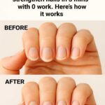 These brown spots appeared almost overnight on my chest, and I can’t see anyone until later this month. What could this be?