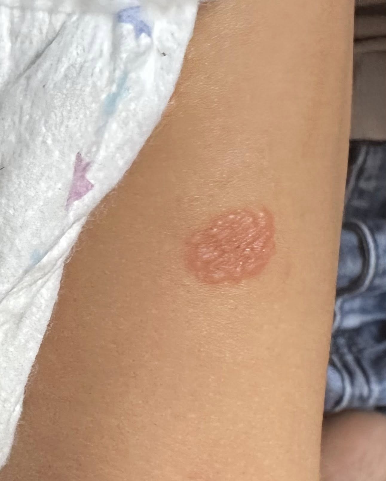 Có thể là hình ảnh về con ve