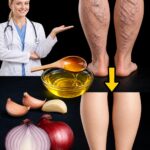 Say Goodbye to Clogged Arteries Naturally: Powerful Foods That Support Heart Health