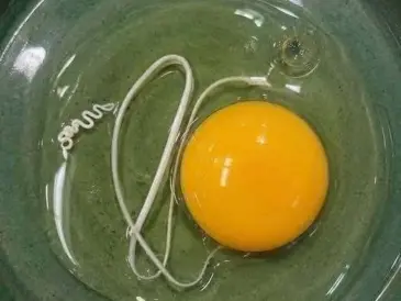 Understanding the Chalaza: Why That White Strand in Your Egg Is Actually a Sign of Freshness - Diy Garden & Home